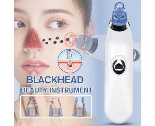 Blackhead Suction Remover & Pore Vacuum | Cell Operated