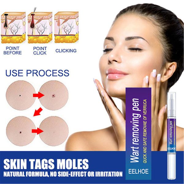 Warts Remover Original Cream