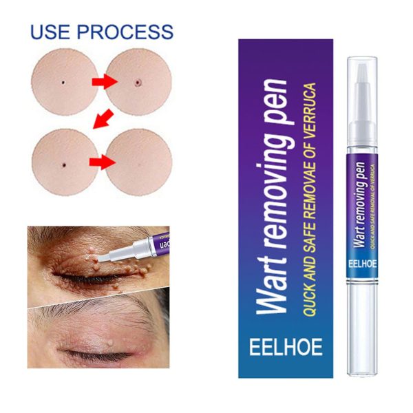 Warts Remover Original Cream