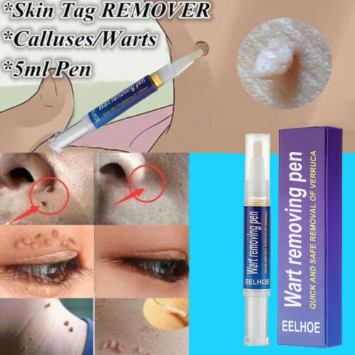 Warts Remover Original Cream